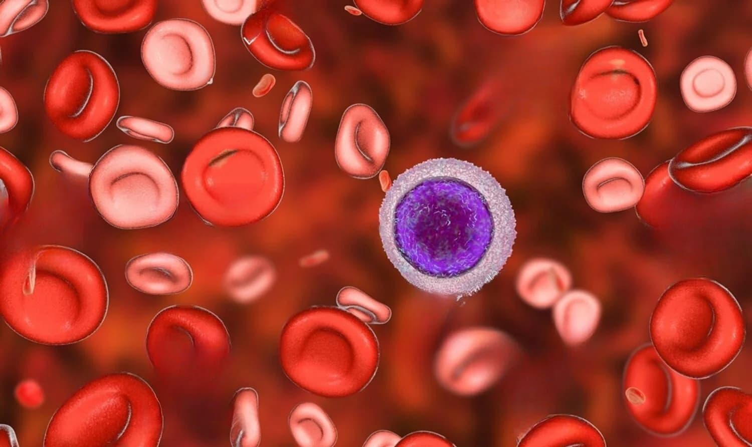 Pediatric Bone Cancer: What Parents Need to Know