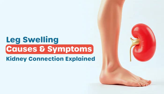 swelling in your legs